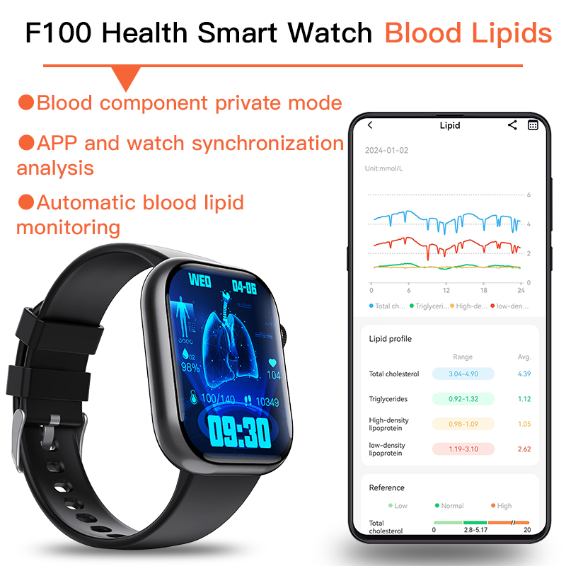 Best ECG Smartwatch of 2025 With Blood Pressure Monitor+Blood Glucose Monitoring
