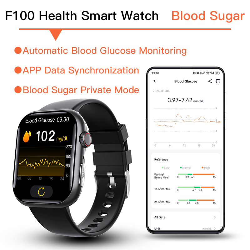 Best ECG Smartwatch of 2025 With Blood Pressure Monitor+Blood Glucose Monitoring