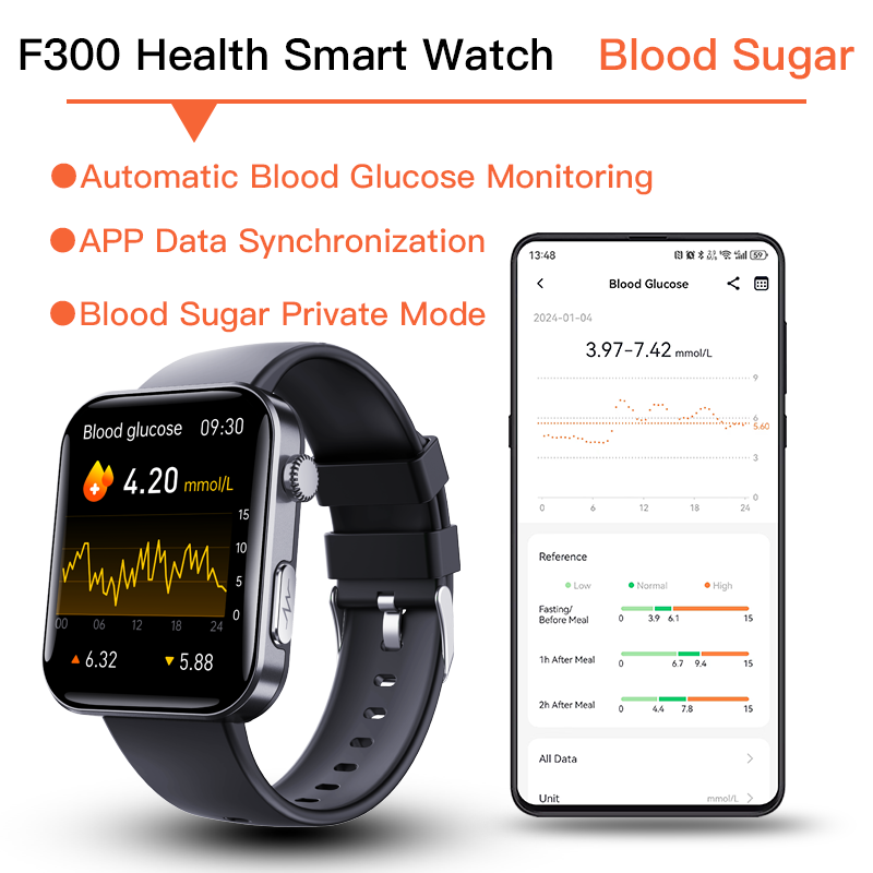ECG smartwatch with blood pressure monitor, body temperature, blood glucose, heart rate, blood oxygen